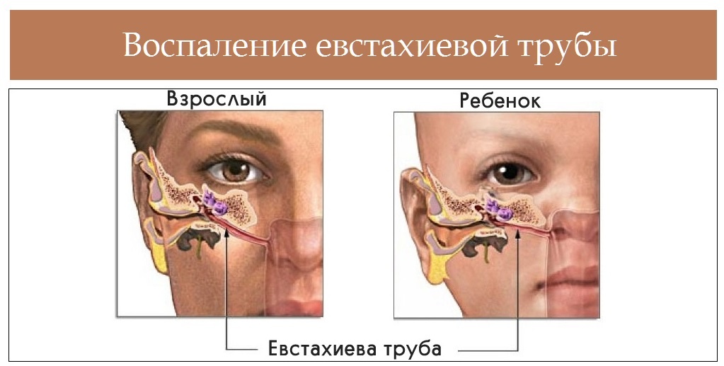 Фото евстахиевой трубы