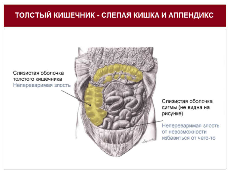 Липома купола слепой кишки что это