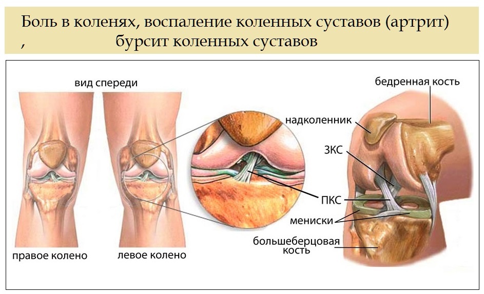 Где находится мениск фото