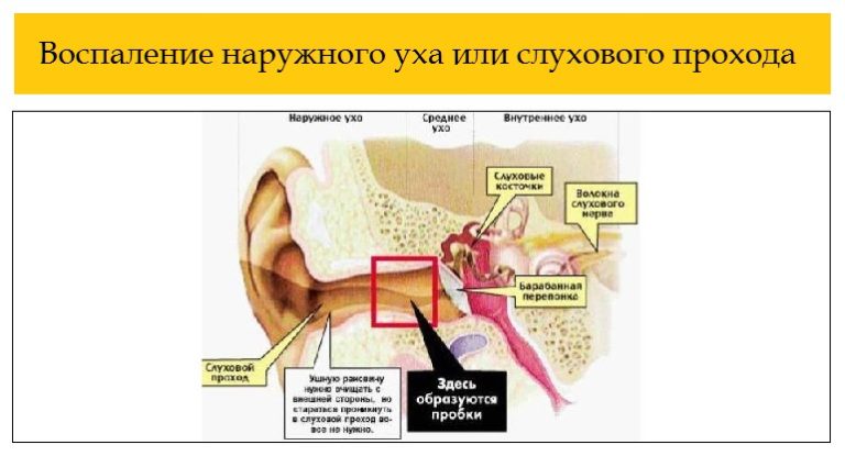 Воспаление наружного уха отит психосоматика, причины